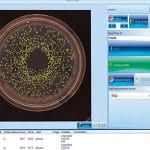 Microbial colony counting in under a minute