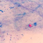 Microfiber filter technology receives NSF certification