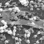 Innovation centre to bring together UK research on biofilms