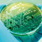 Using microbes to remove microplastics Pseudomonas aeruginosa colonies collected on a laboratory plate