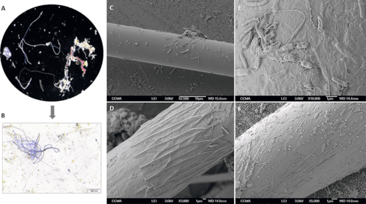 Photomicrograph of floating fibers collected from the coastal zone of the northwestern Mediterranean