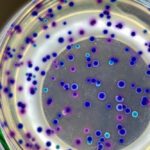 Study indicates marine plastic pollution as a breeding ground for disease-causing bacteria